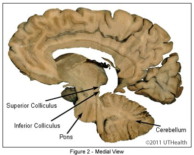 Mesencephalon - Midbrain