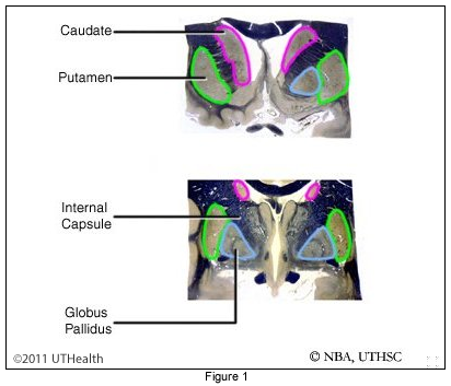 Other Structures - Globus Pallidus and Putamen