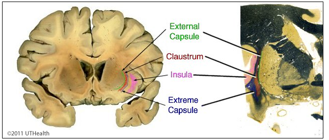 Neuroanatomy Lab Online, Lab 2 Page 15