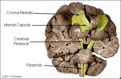 Corticospinal Fibers - Overview