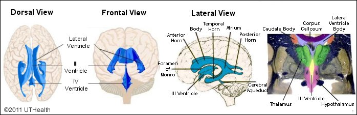 The Ventricles