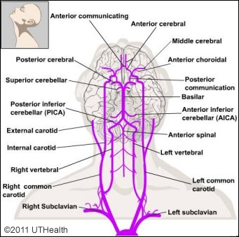 Vertebral-Basilar System