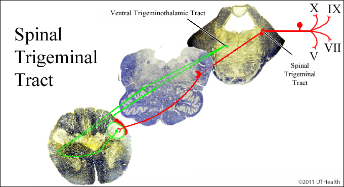 Spinal Trigeminal Pathway