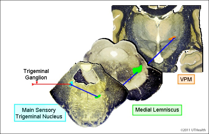 Main Sensory Trigeminal Pathway