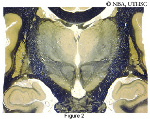 Diencephalon, coronal section