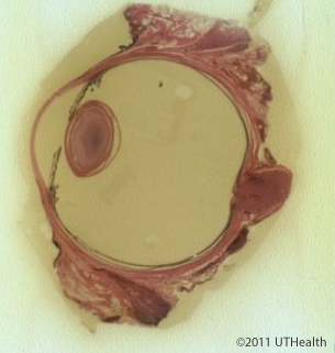 Gross Anatomy of the Eye