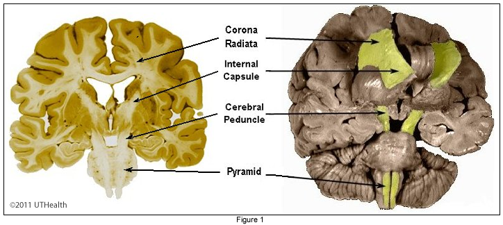 Corticospinal (pyramidal) Pathway