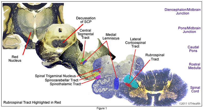 Rubrospinal Tract