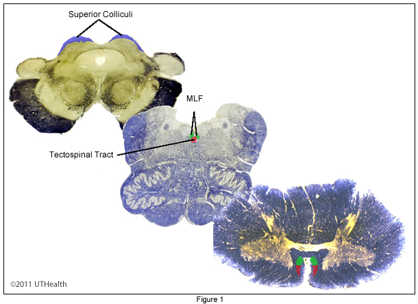 Tectospinal Tract