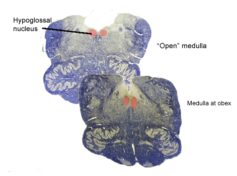 Cranial Nerve XII-Hypoglossal Nerve