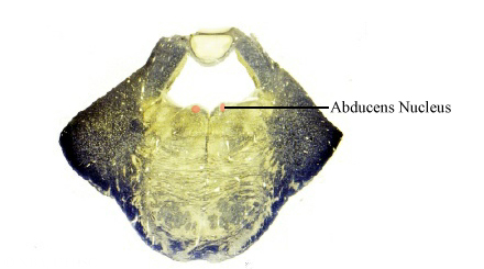 Abducens Nerve