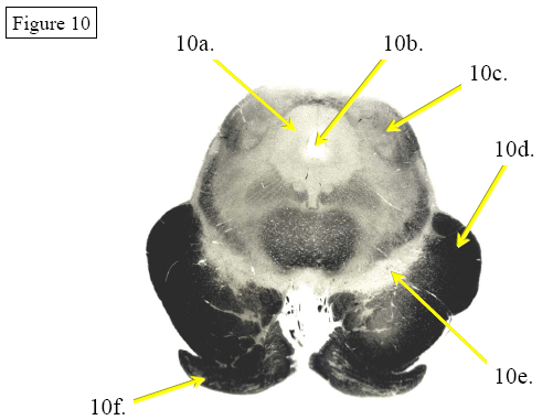 Figure 10