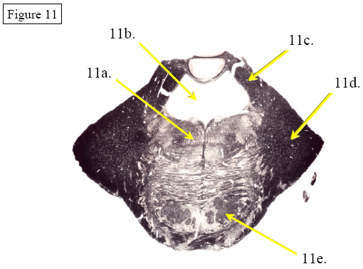 Figure 11