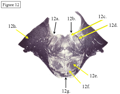 Figure 12