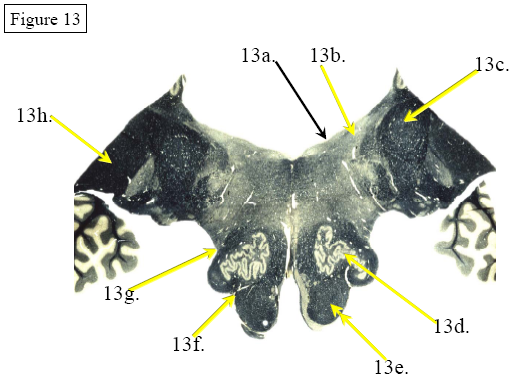 Figure 13