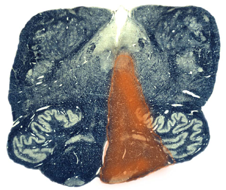 Figure 18