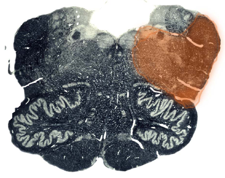 Figure 19